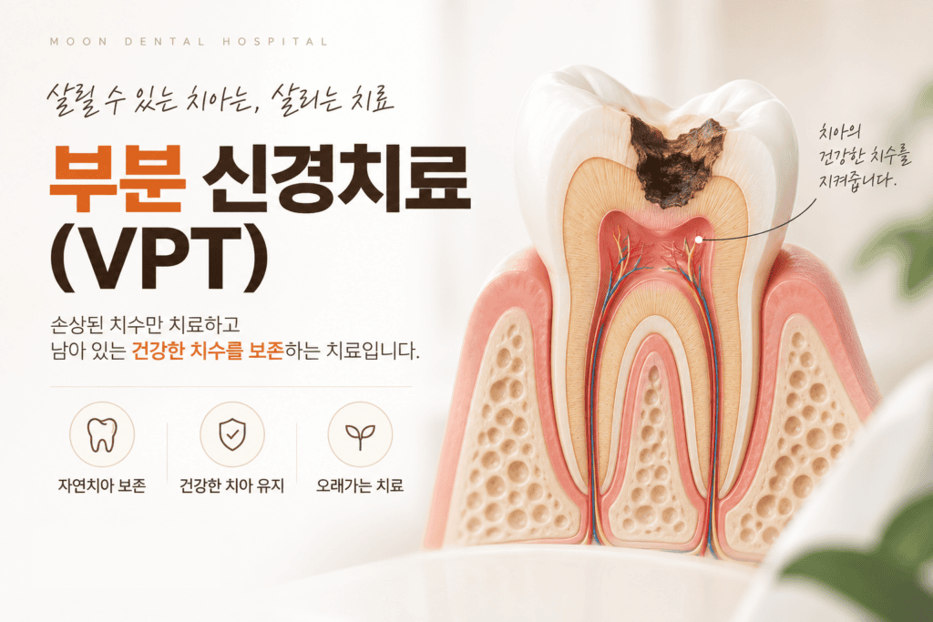 부분 신경치료 VPT를 통해 건강한 치수를 보존하는 개념을 설명한 이미지