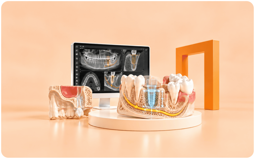 문치과병원 임플란트 식립 위치 계획을 위한 CBCT 검사 이미지